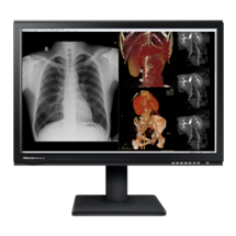 醫(yī)用顯示器、診斷顯示器