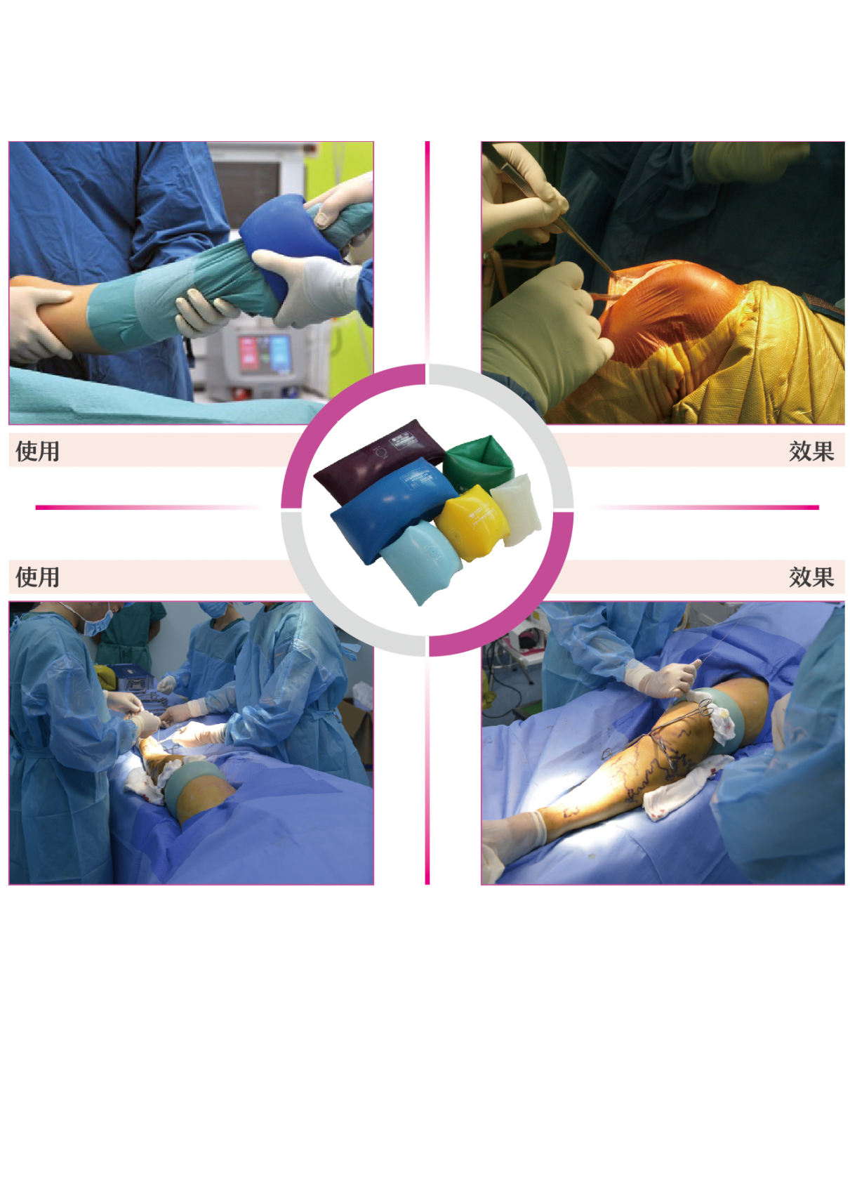 驅(qū)血器（肢體壓力套）：主要針對手術(shù)室的產(chǎn)品。