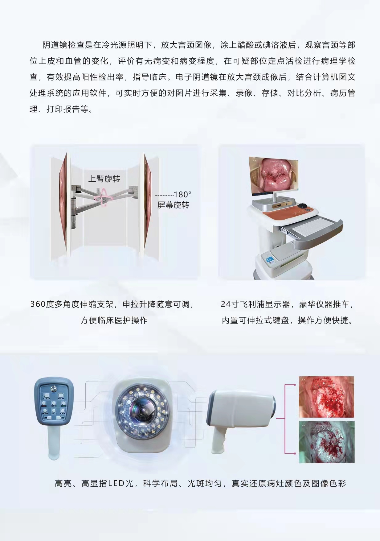 數(shù)碼電子陰道鏡產(chǎn)品說(shuō)明